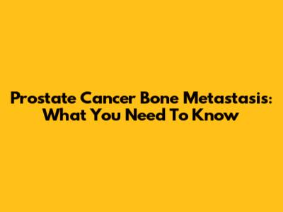 Prostate Cancer Bone Metastasis: What You Need To Know